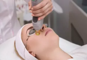 IPL Photofacial